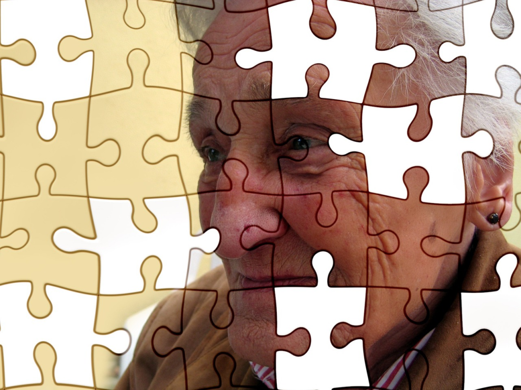 Alzheimer, estratégias para um cuidado humanizado.