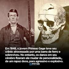 A Incrível História de Phineas Gage.